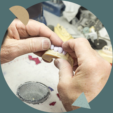 dental implant fabrication