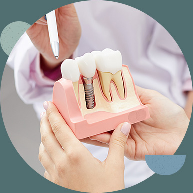 dental implant