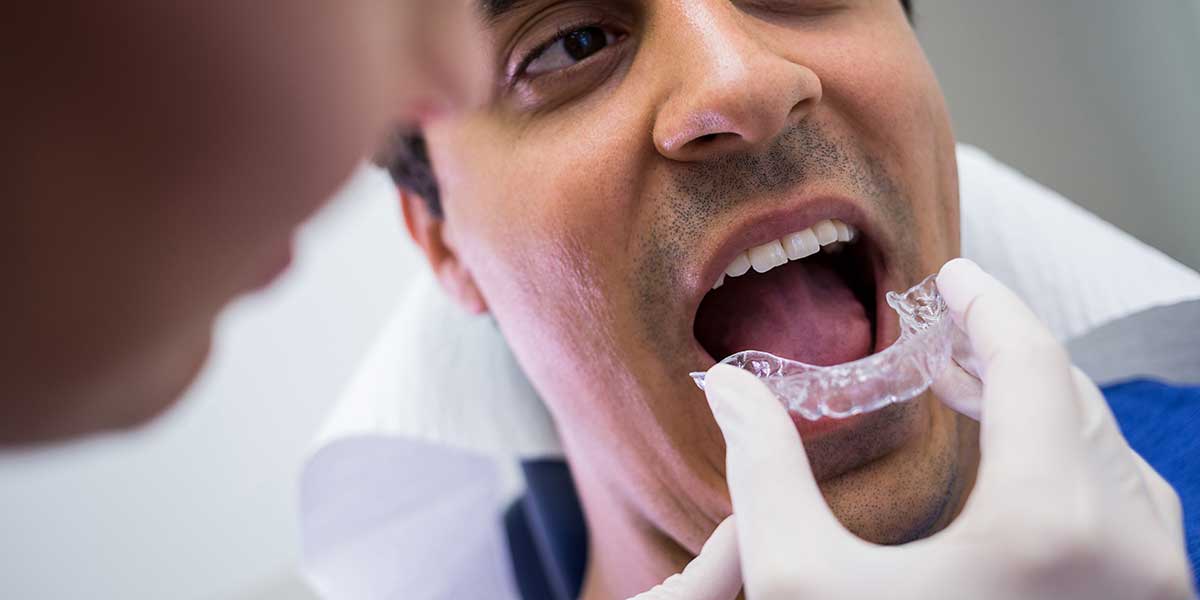 The Complete Patient’s Guide to Invisalign in Surrey: Improve Your Smile Discreetly