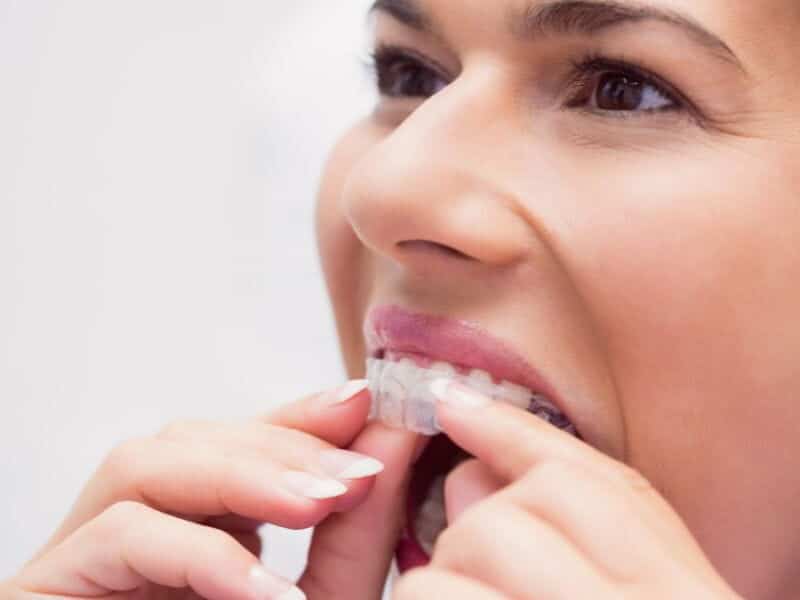 how often do you need to change invisalign trays