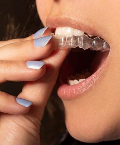 can you drink coffee with invisalign​