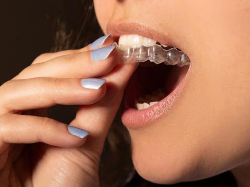 can you drink coffee with invisalign​