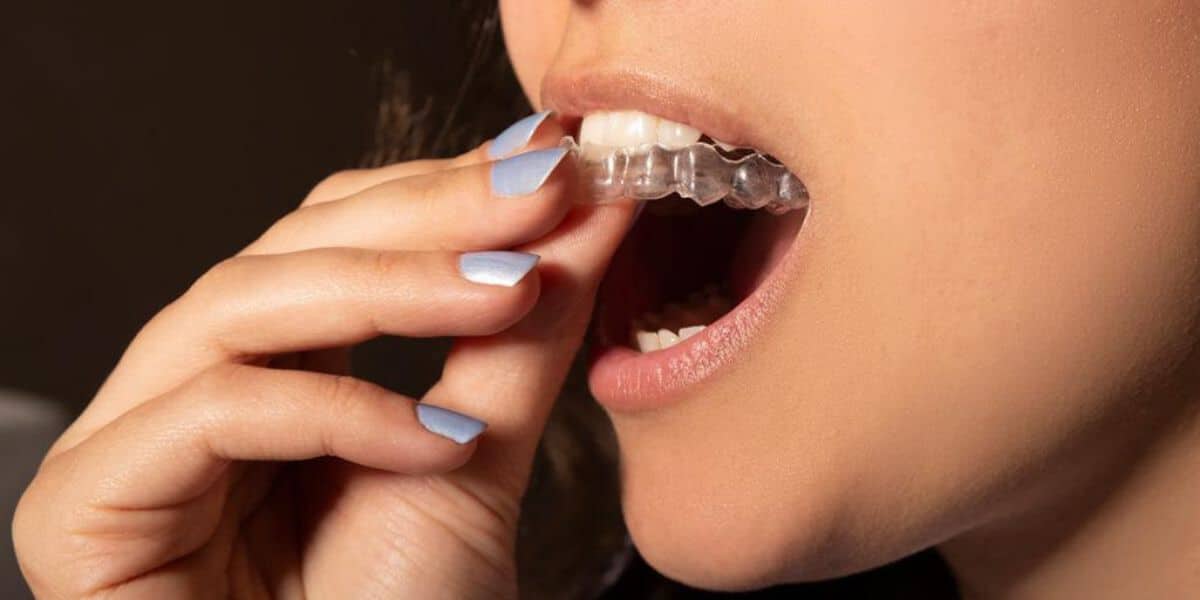 Can You Drink Coffee While Wearing Invisalign?