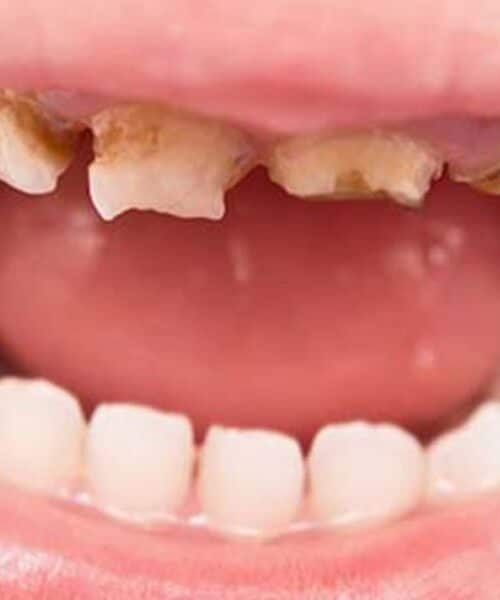 common dental problems
