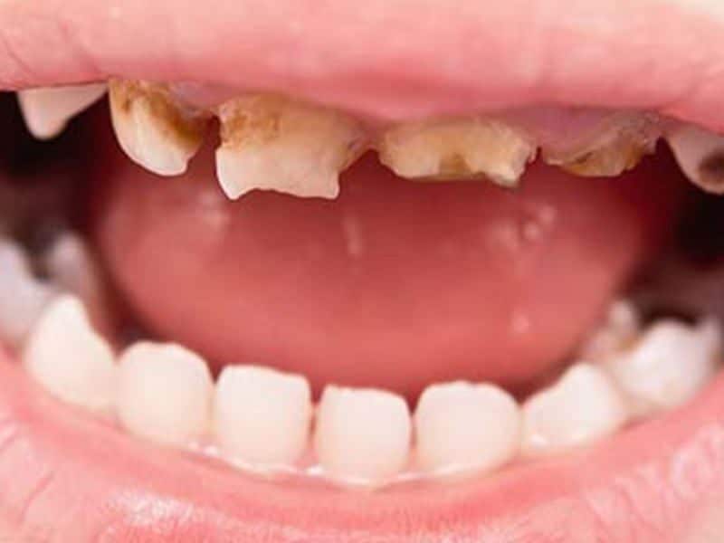 common dental problems