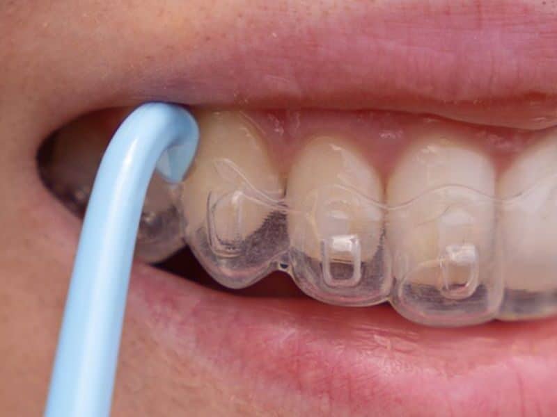 Orthodontist showing Invisalign clear aligners to a patient during a consultation about treatment duration | How Long Does Invisalign Treatment Take?