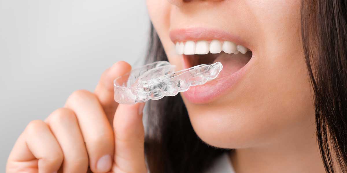Is There an Age Limit for Invisalign?