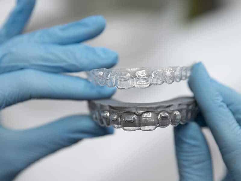 Gloved hands hold a clear plastic aligner tray above a dental mold during an Invisalign treatment refinement process assessment.